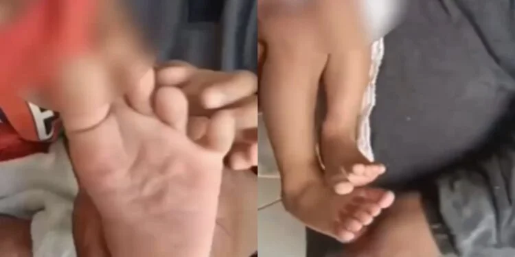 Mulher é presa após filho de 1 ano ser encontrado sozinho e com os pés queimados em condomínio de Manaus
