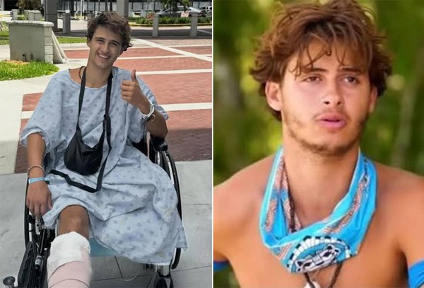 Jovem pede indenização após perder perna em reality show